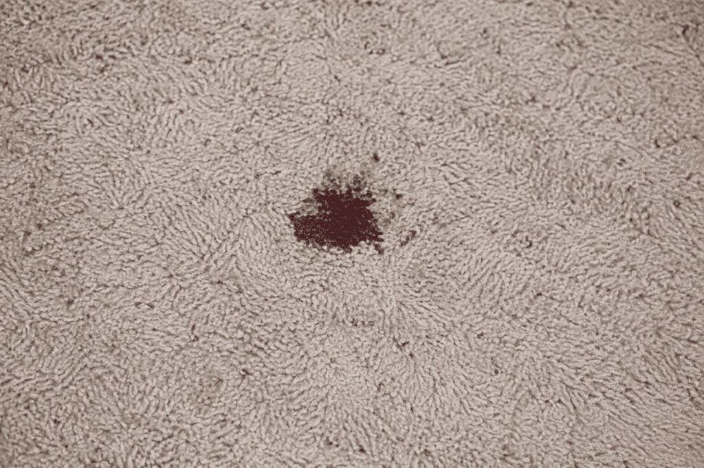blood stain removal