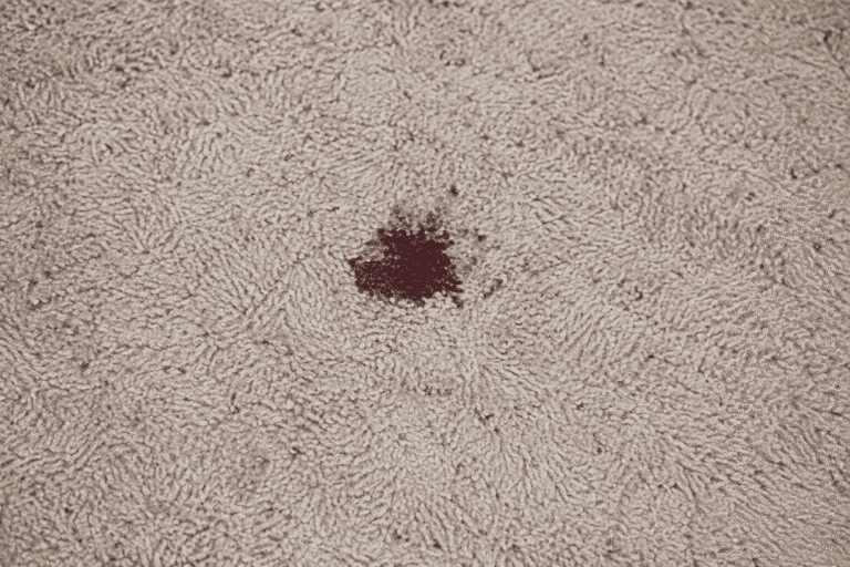 blood stain removal